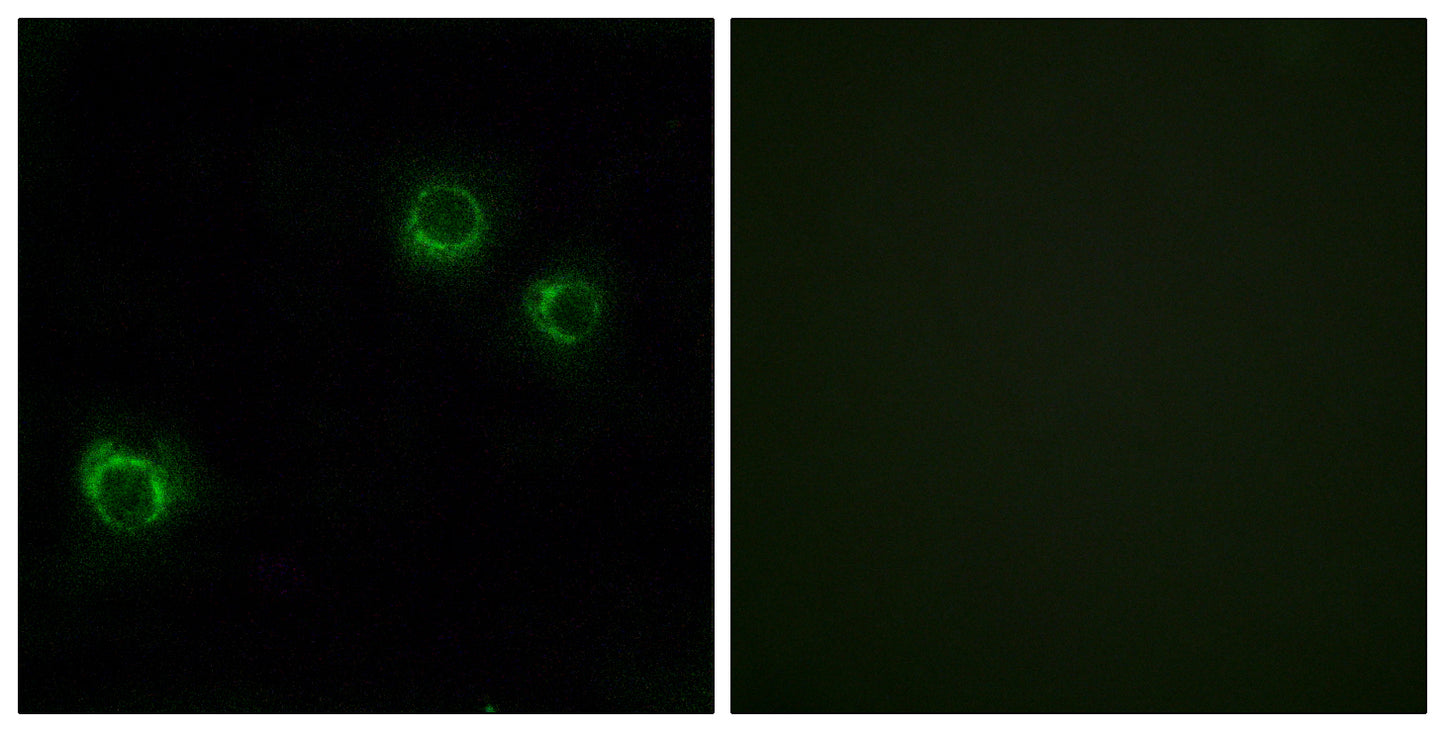 Claudin-6 Rabbit Polyclonal Antibody