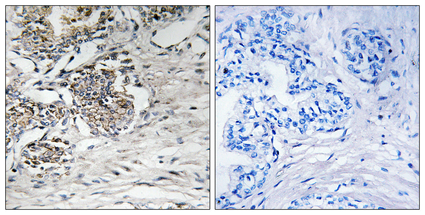 Claudin-7 Rabbit Polyclonal Antibody