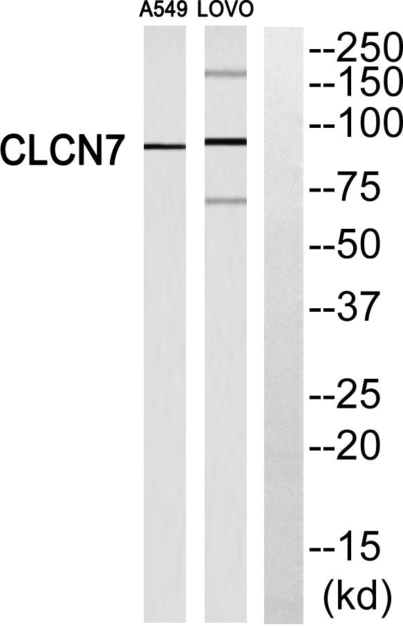 CLC-7 Rabbit Polyclonal Antibody