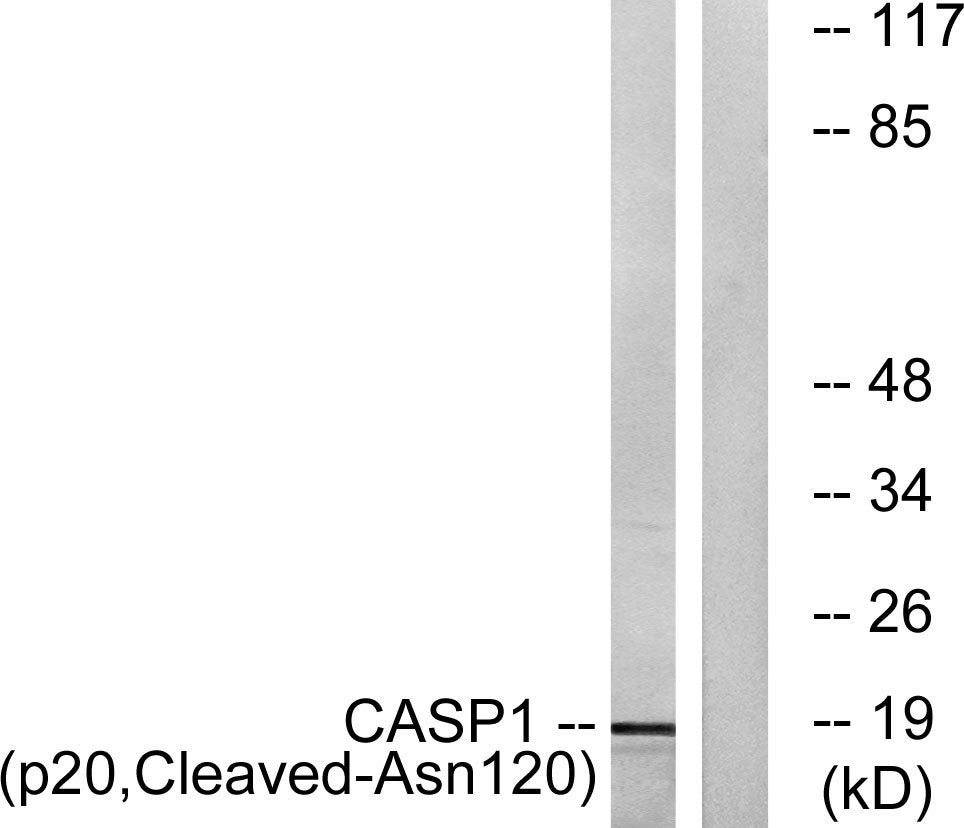 Cleaved-Caspase-1 p20 (N120) Rabbit Polyclonal Antibody