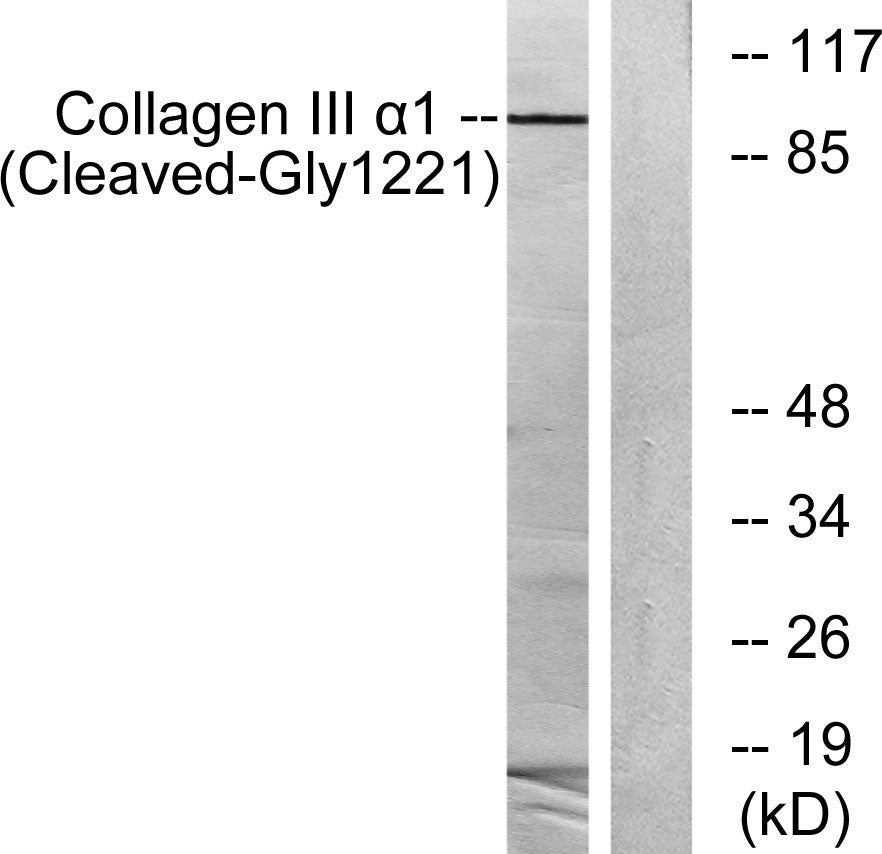 Cleaved-COL3A1 (G1221) Rabbit Polyclonal Antibody