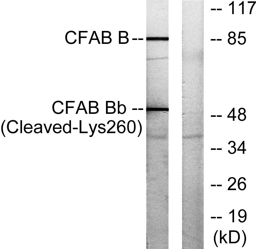 Cleaved-Factor B Bb (K260) Rabbit Polyclonal Antibody