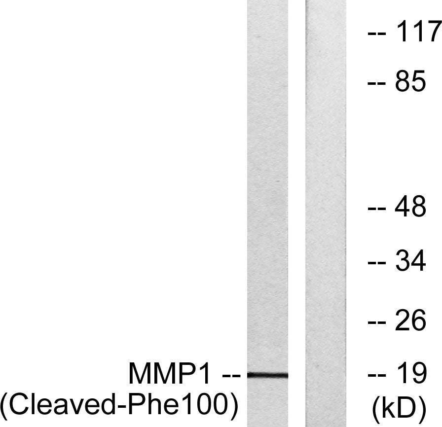 Cleaved-MMP-1 22k (F100) Rabbit Polyclonal Antibody