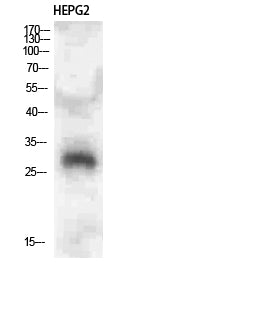 CLECSF6 Rabbit Polyclonal Antibody