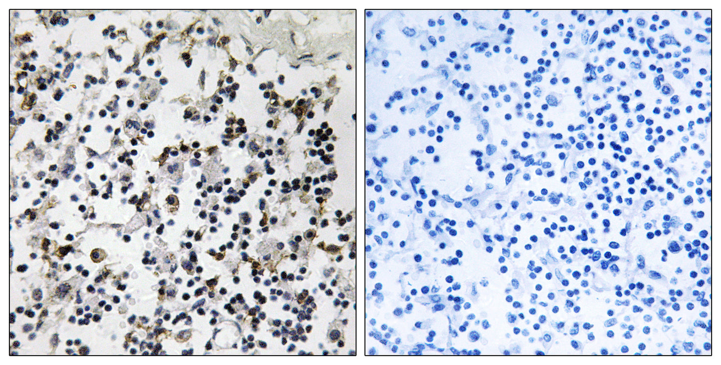 CLIC4 Rabbit Polyclonal Antibody