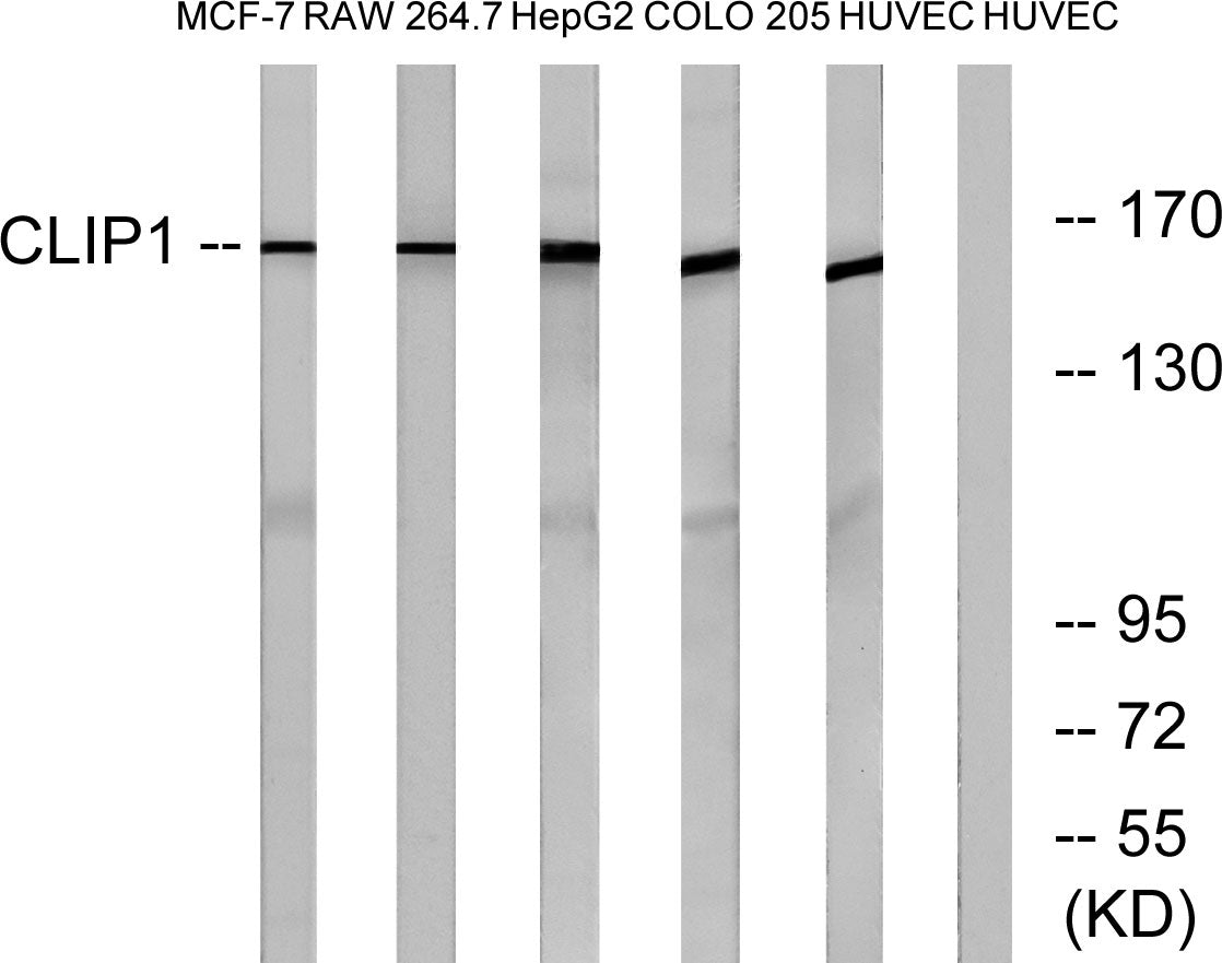 CLIP-170 Rabbit Polyclonal Antibody