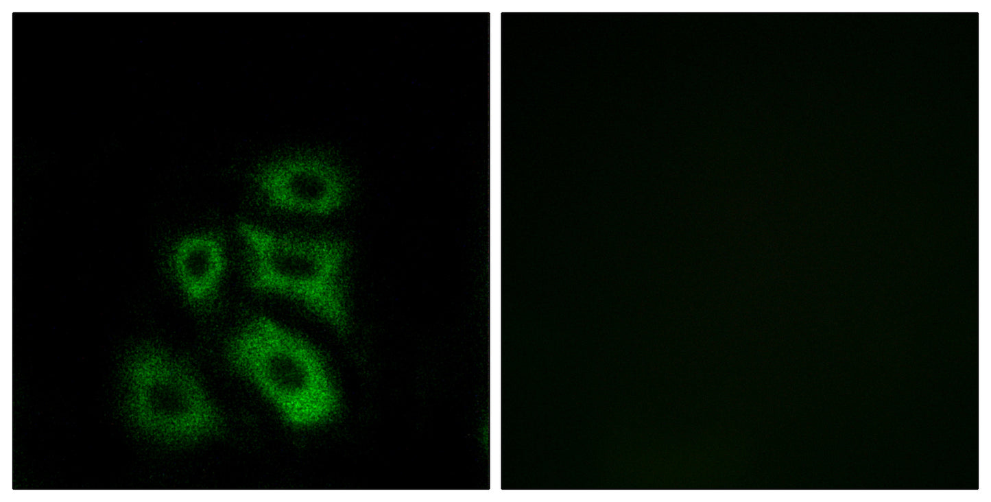 CLIP3 Rabbit Polyclonal Antibody