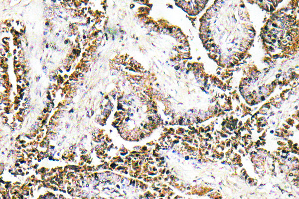 CLN1 Rabbit Polyclonal Antibody