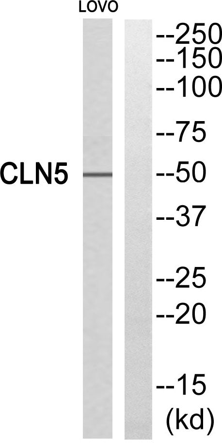 CLN5 Rabbit Polyclonal Antibody
