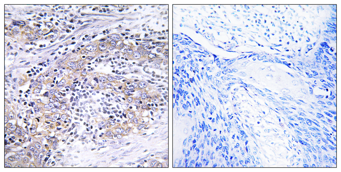 CLN6 Rabbit Polyclonal Antibody