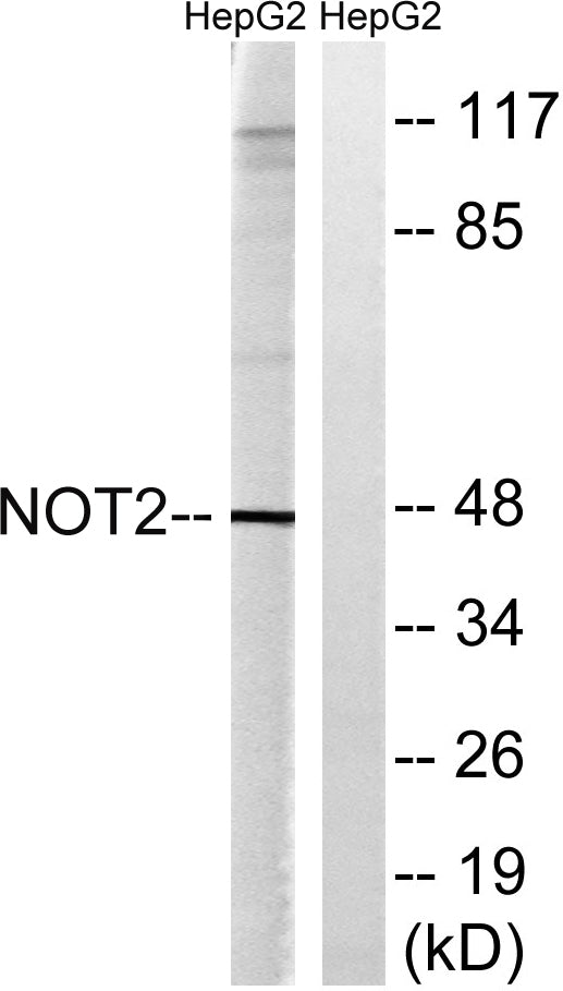 CNOT2 Rabbit Polyclonal Antibody