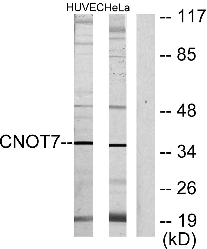 CNOT7 Rabbit Polyclonal Antibody
