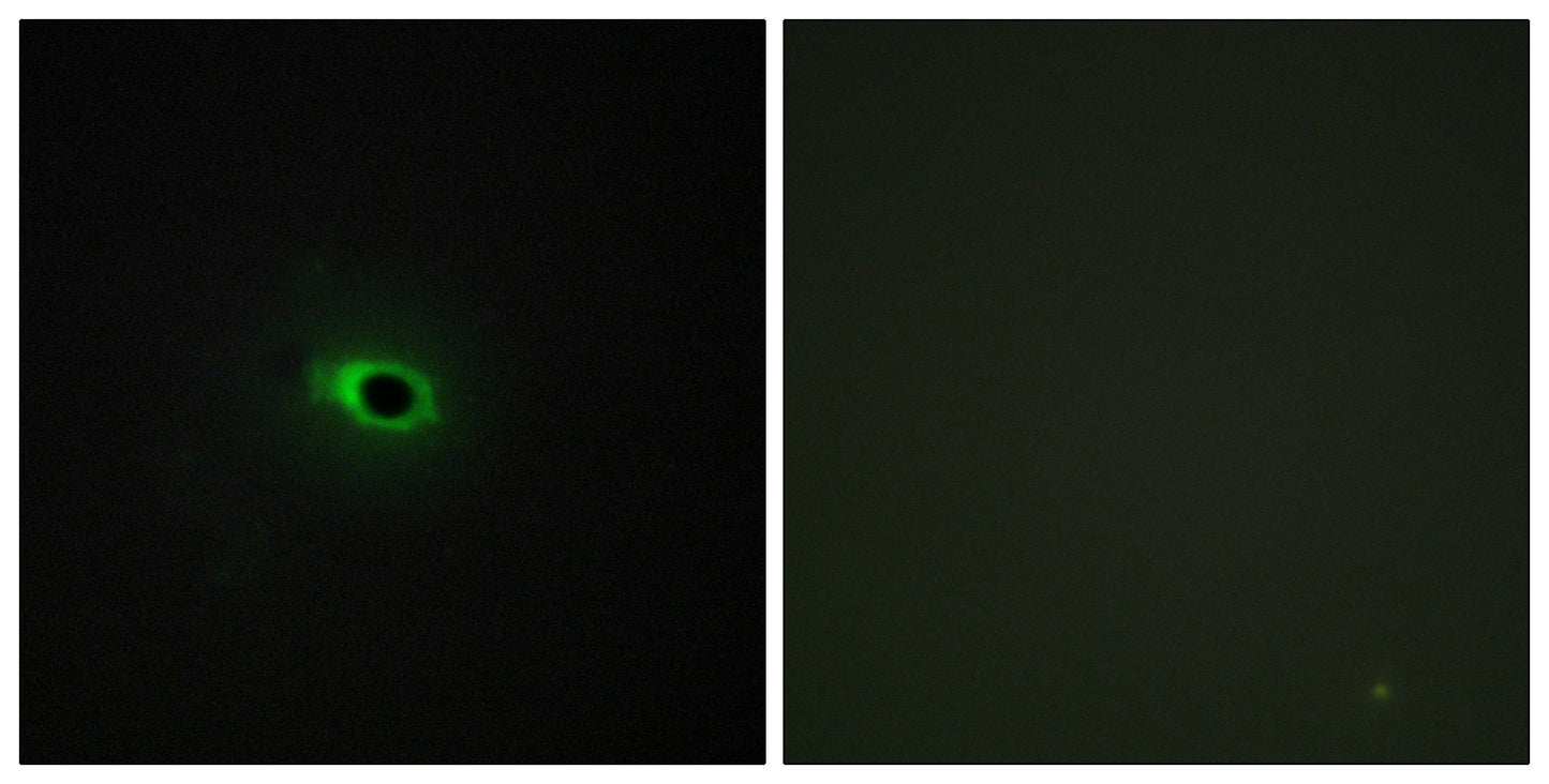 COL12A1 Rabbit Polyclonal Antibody