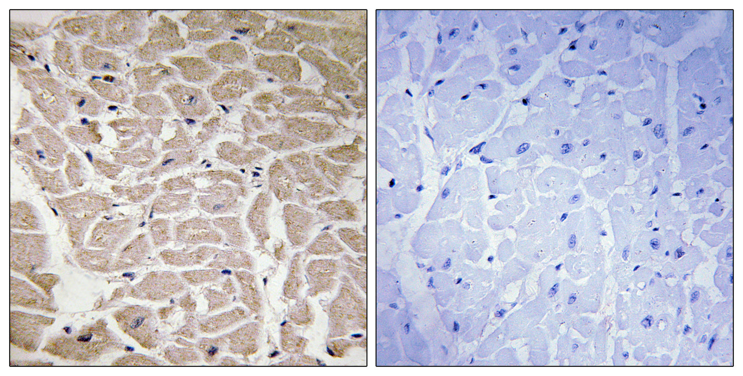 COL16A1 Rabbit Polyclonal Antibody