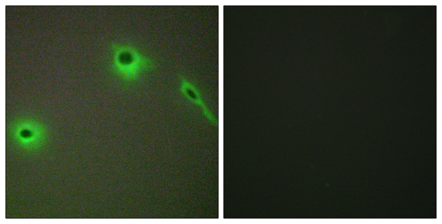 COL18A1 Rabbit Polyclonal Antibody