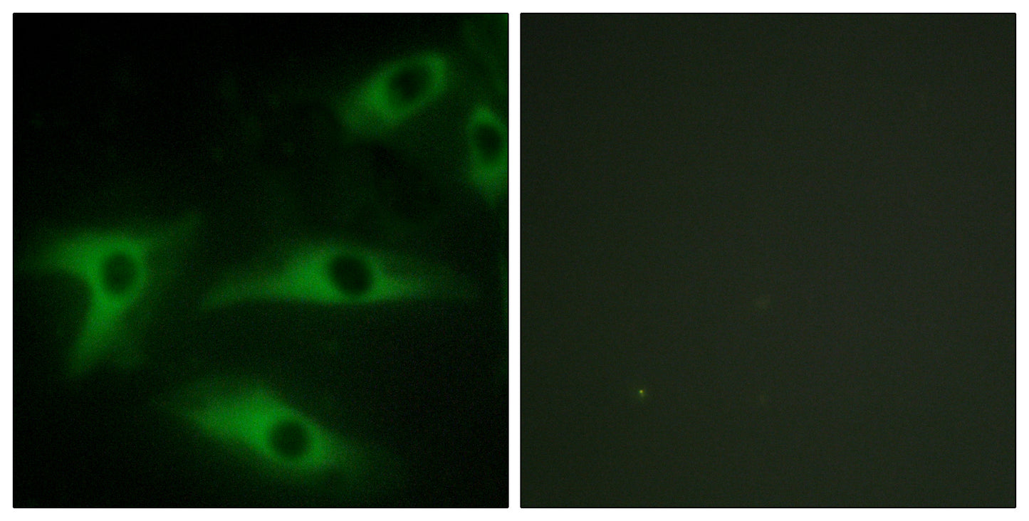 COL1A2 Rabbit Polyclonal Antibody