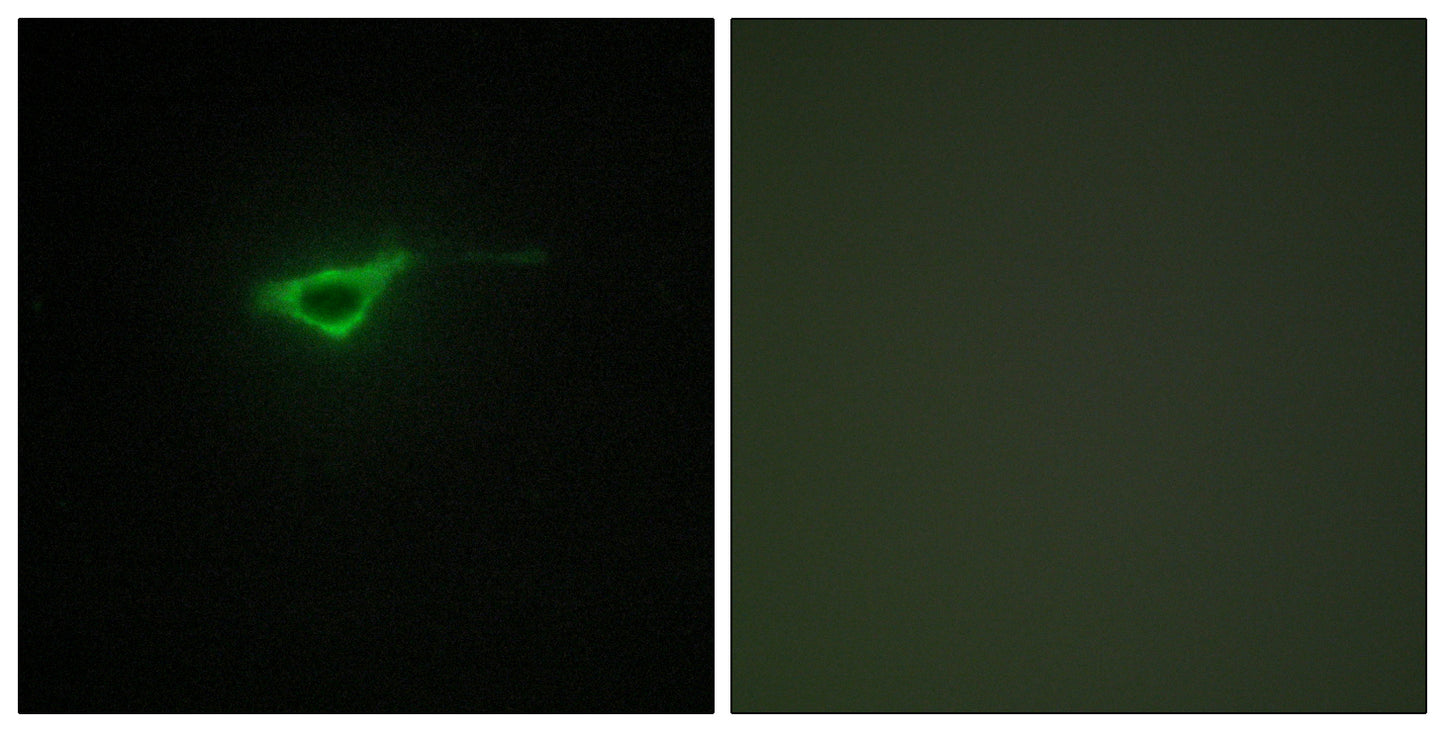 COL20A1 Rabbit Polyclonal Antibody