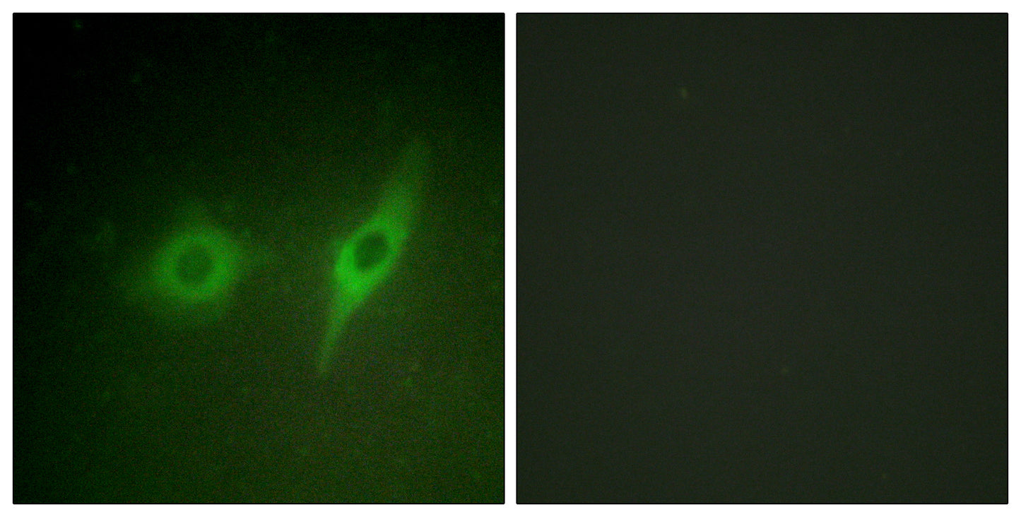 COL4A2 Rabbit Polyclonal Antibody