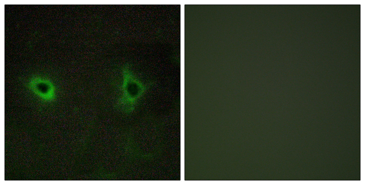 COL4A3 Rabbit Polyclonal Antibody