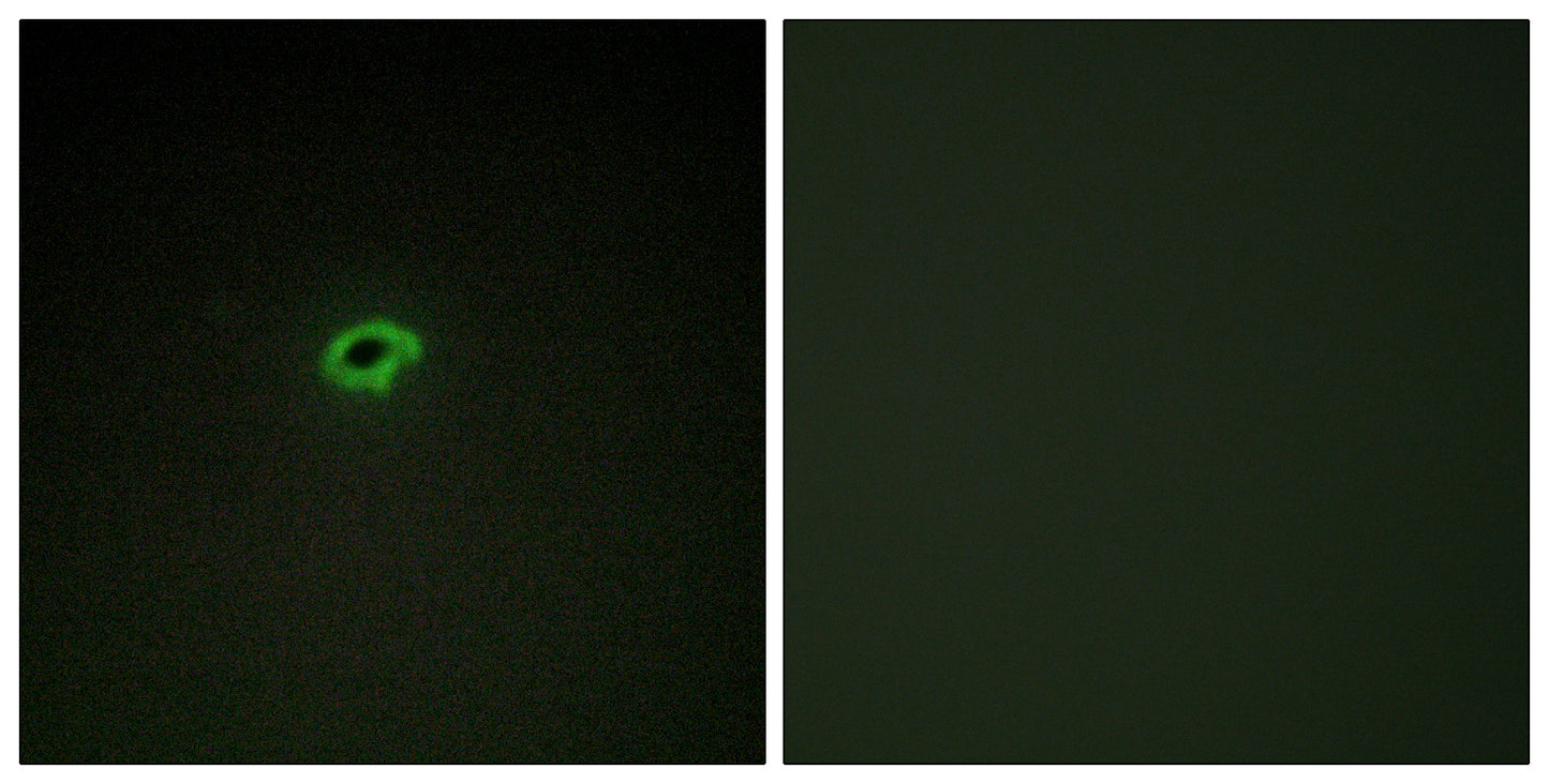 COL4A4 Rabbit Polyclonal Antibody