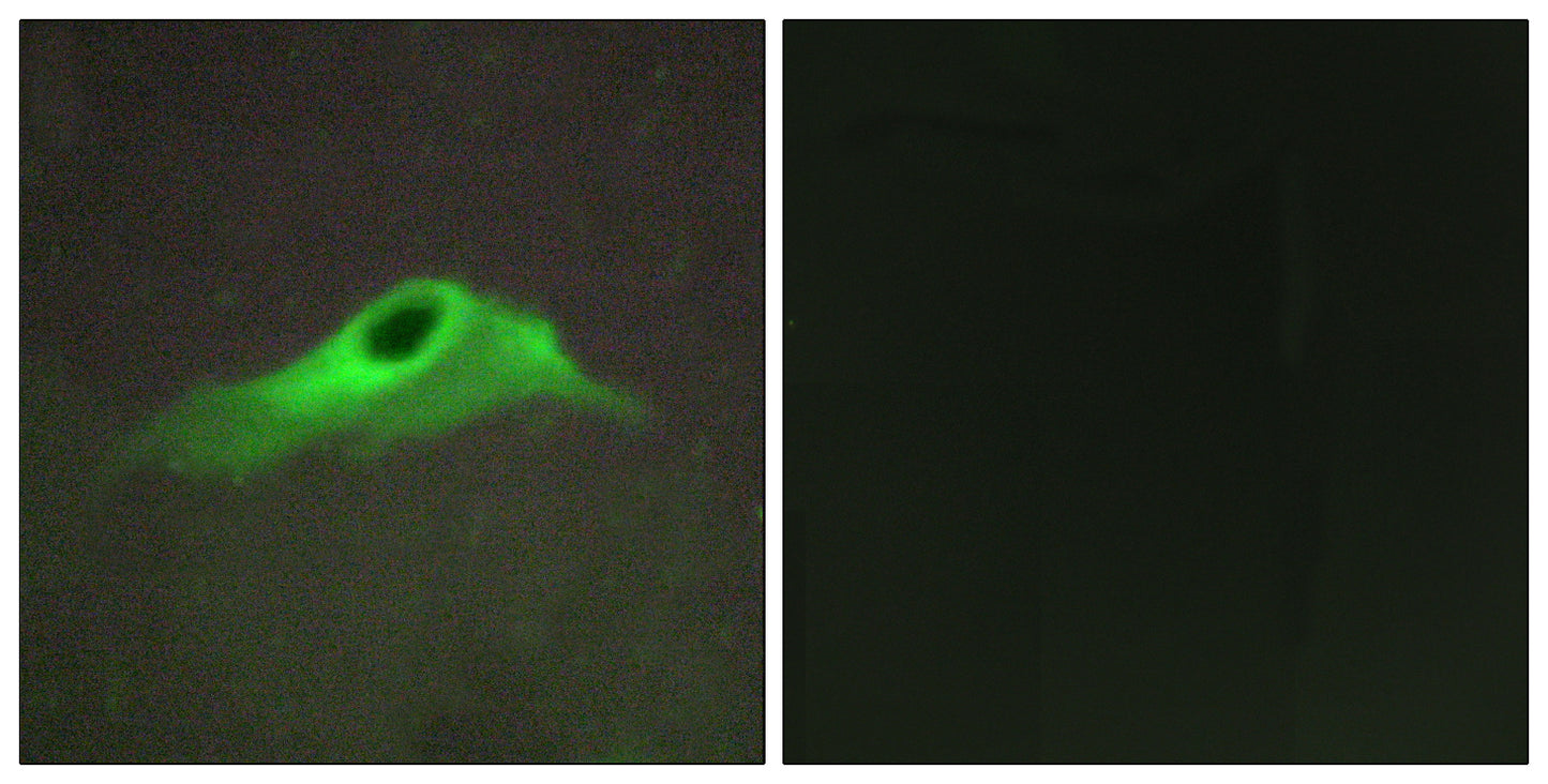 COL4A5 Rabbit Polyclonal Antibody