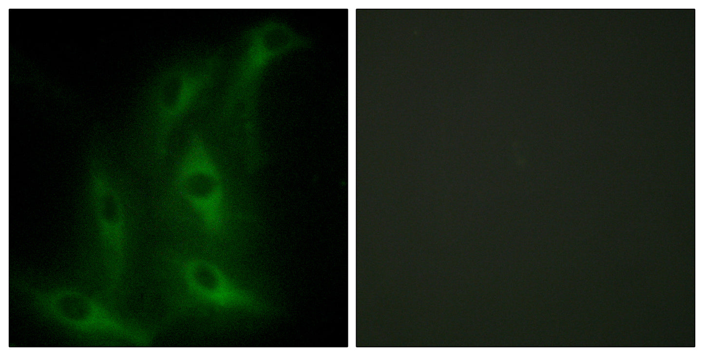 COL4A6 Rabbit Polyclonal Antibody