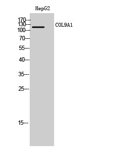 COL9A1 Rabbit Polyclonal Antibody