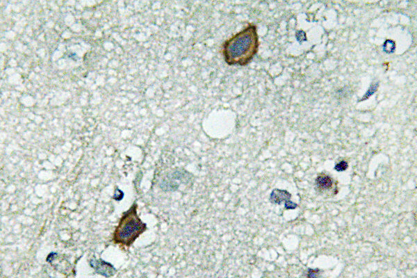 Connexin-45 Rabbit Polyclonal Antibody