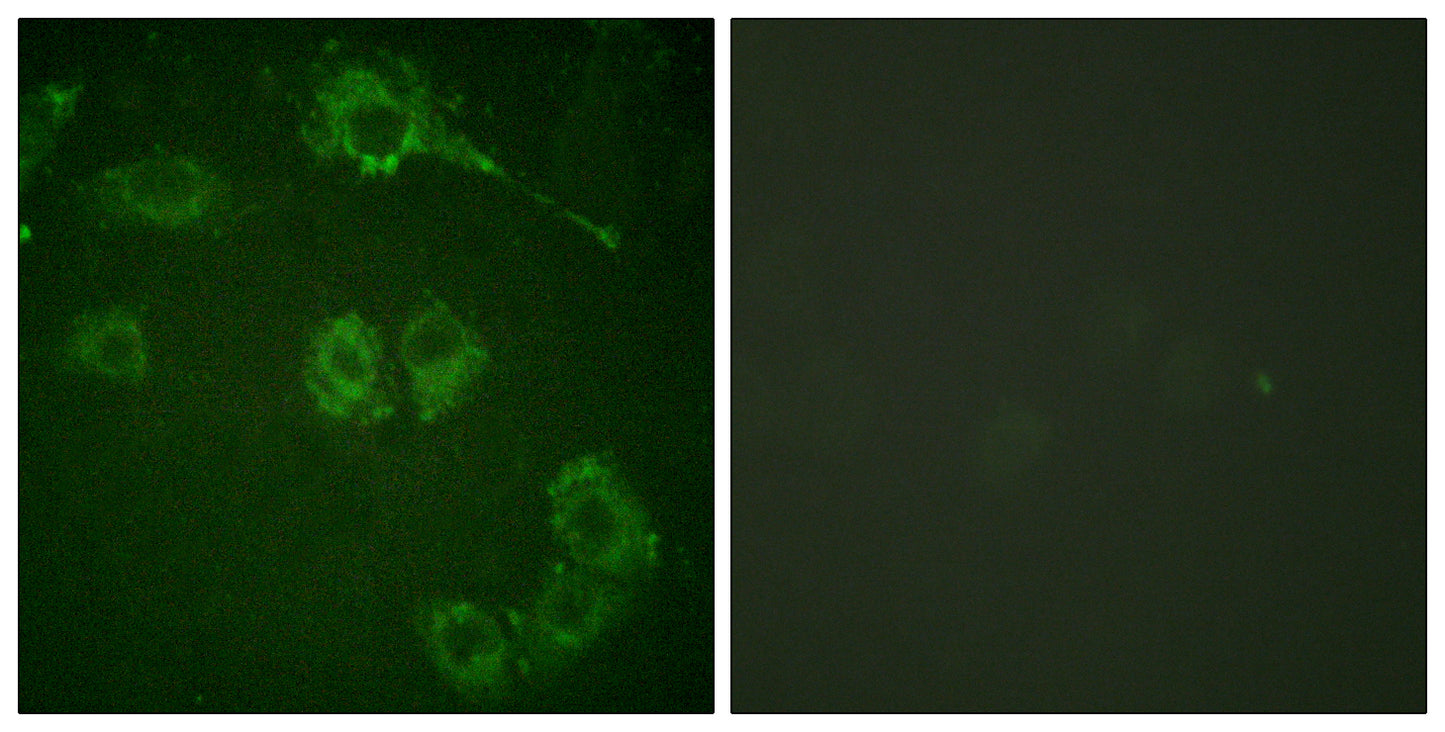COT Rabbit Polyclonal Antibody