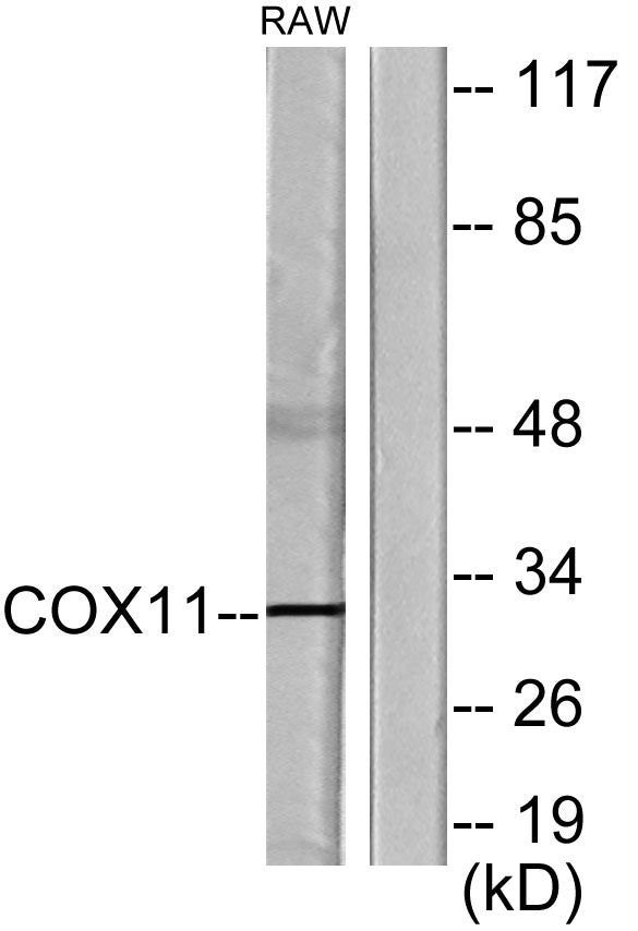 COX11 Rabbit Polyclonal Antibody