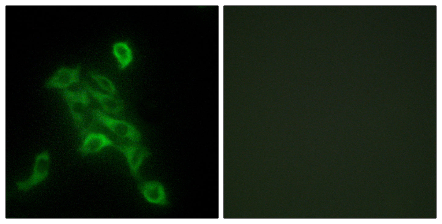 COX6c Rabbit Polyclonal Antibody