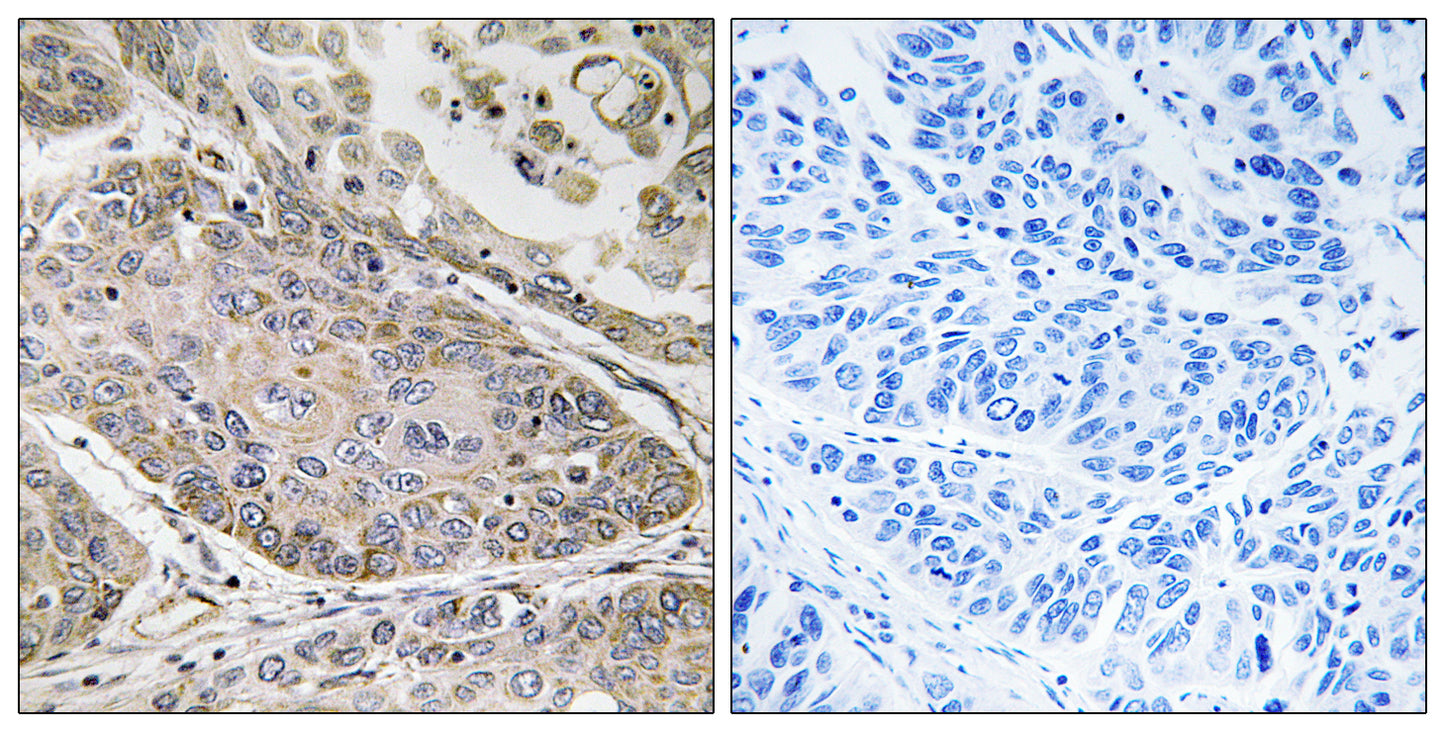 cPLA2-ε Rabbit Polyclonal Antibody