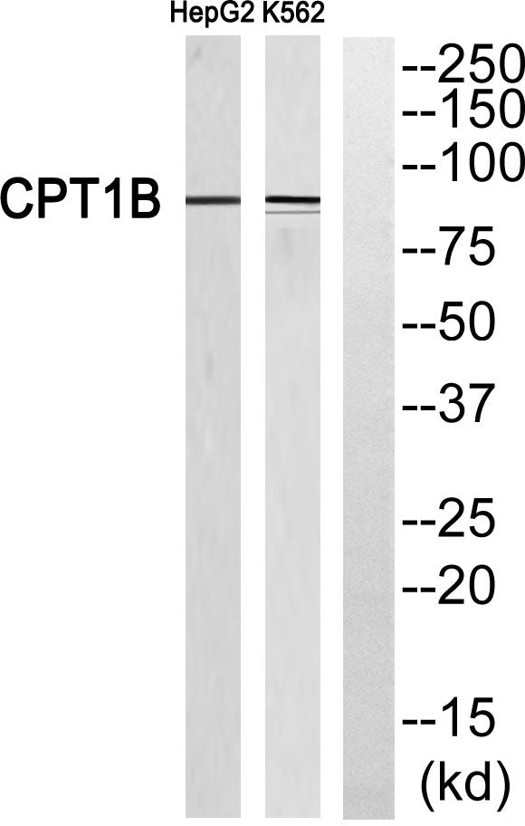CPTI-M Rabbit Polyclonal Antibody
