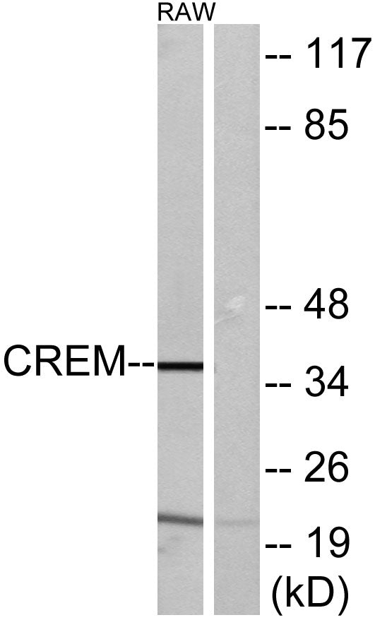 CREM Rabbit Polyclonal Antibody