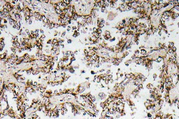 CRF Rabbit Polyclonal Antibody