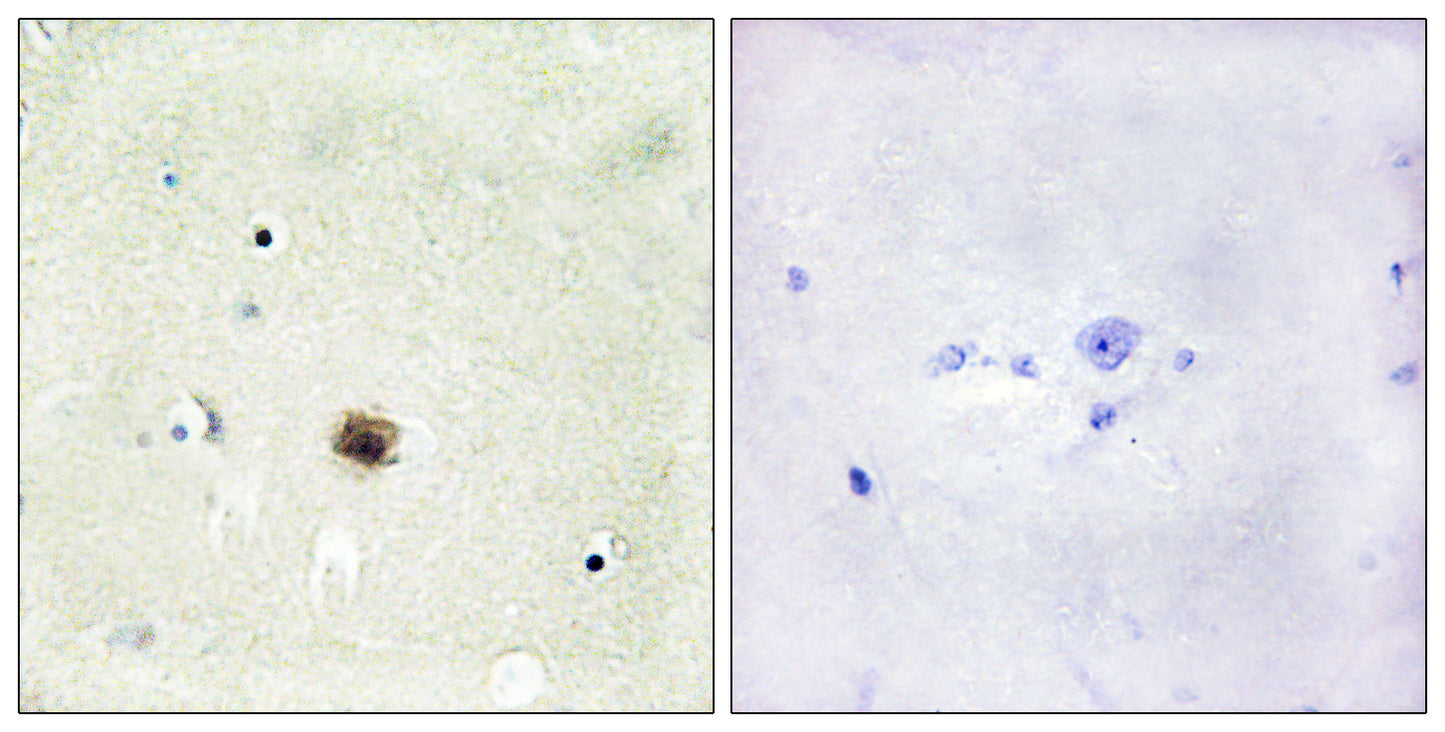 CRP1 Rabbit Polyclonal Antibody