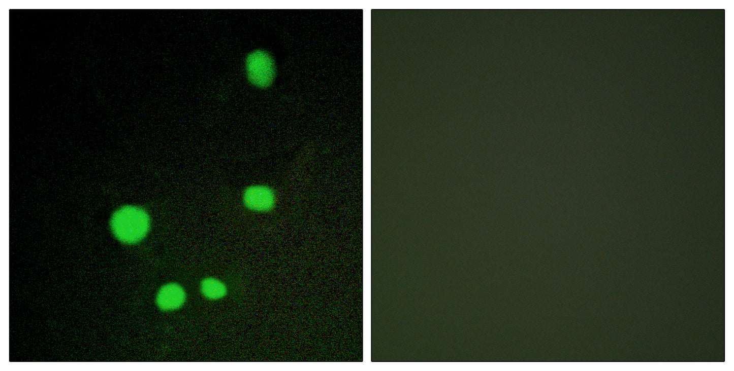 CRSP150 Rabbit Polyclonal Antibody