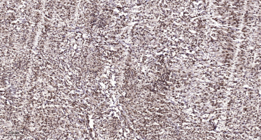 CSB Rabbit Polyclonal Antibody