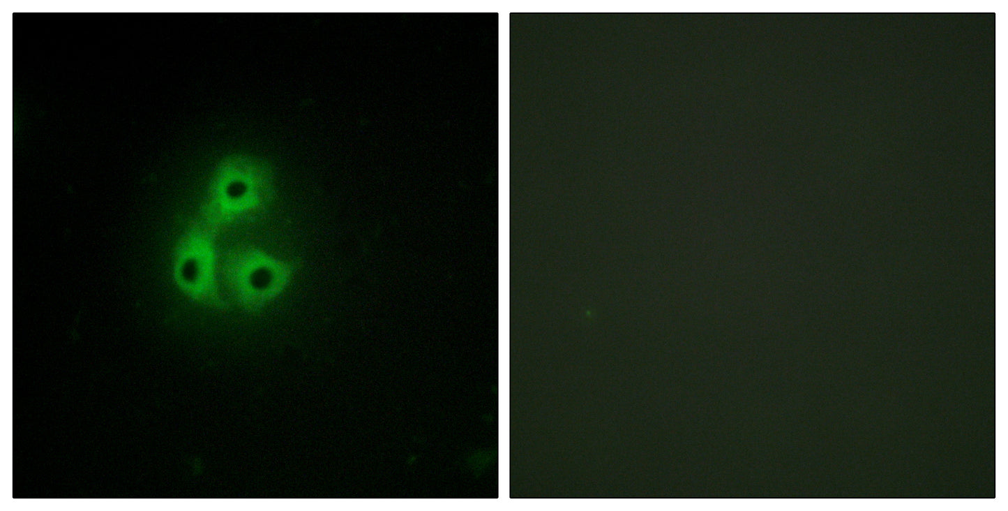 Csk Rabbit Polyclonal Antibody