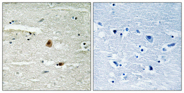 CSN1 Rabbit Polyclonal Antibody