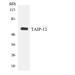 CSRNP2 Rabbit Polyclonal Antibody