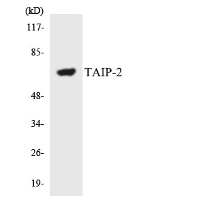 CSRNP3 Rabbit Polyclonal Antibody