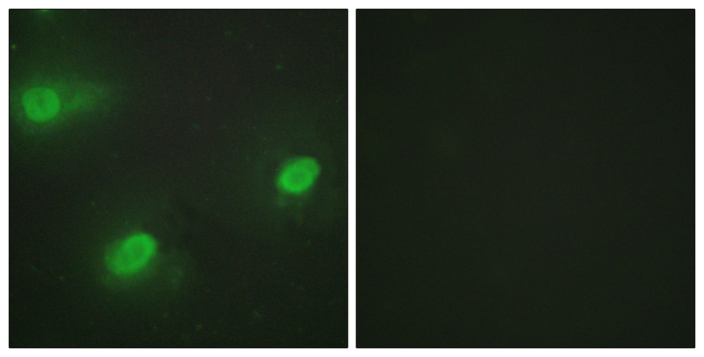 CstF-64 Rabbit Polyclonal Antibody