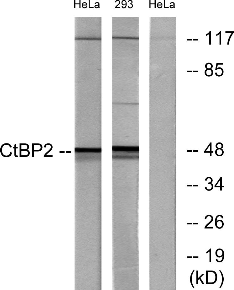 CtBP2 Rabbit Polyclonal Antibody