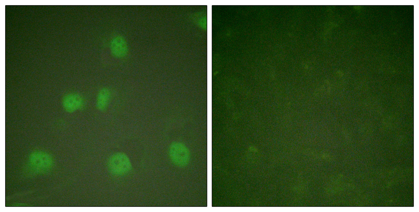 CUL-1 Rabbit Polyclonal Antibody