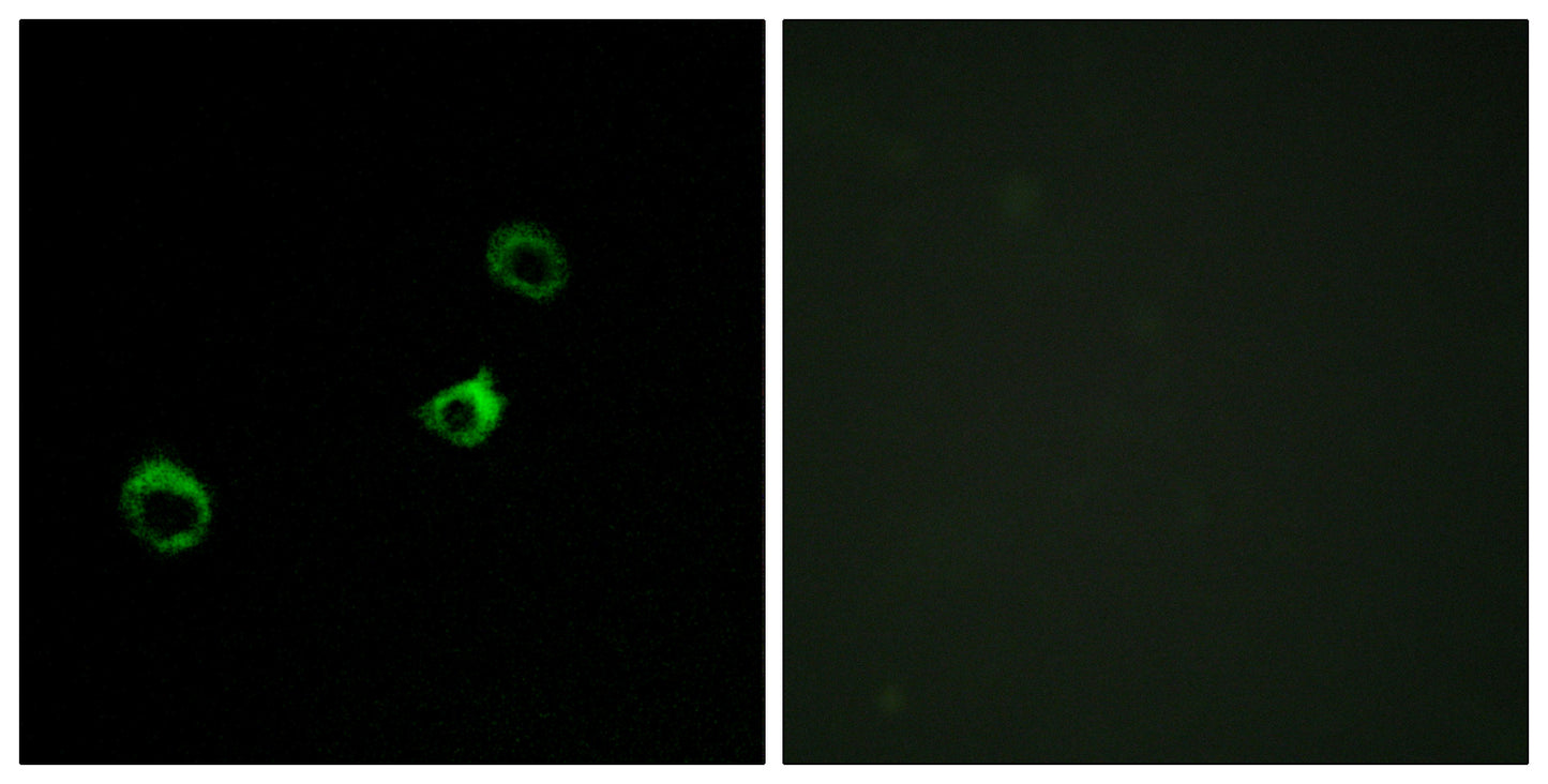 CYB561D1 Rabbit Polyclonal Antibody