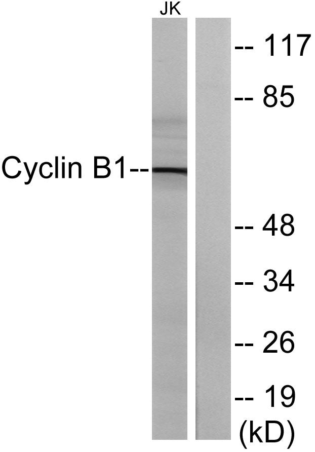 Cyclin B1 Rabbit Polyclonal Antibody