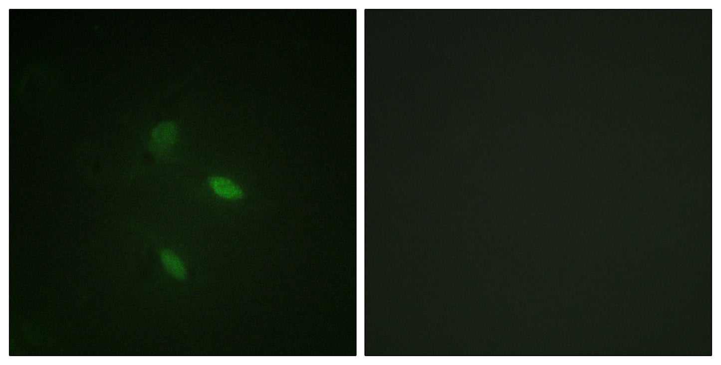Cyclin E2 Rabbit Polyclonal Antibody