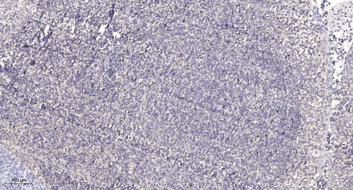 Cyclin T2 Rabbit Polyclonal Antibody