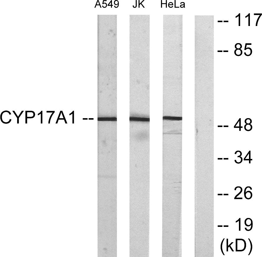 CYP17A1 Rabbit Polyclonal Antibody